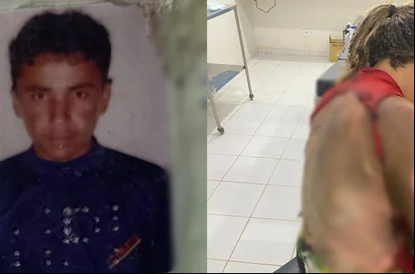 Homem é preso por atear fogo na esposa enquanto ela dormia